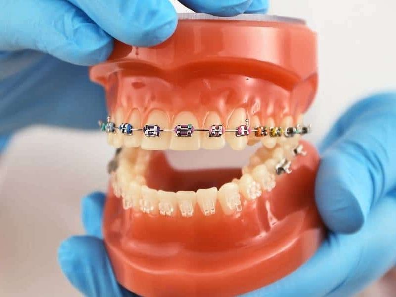Seattle Orthodontics consultation