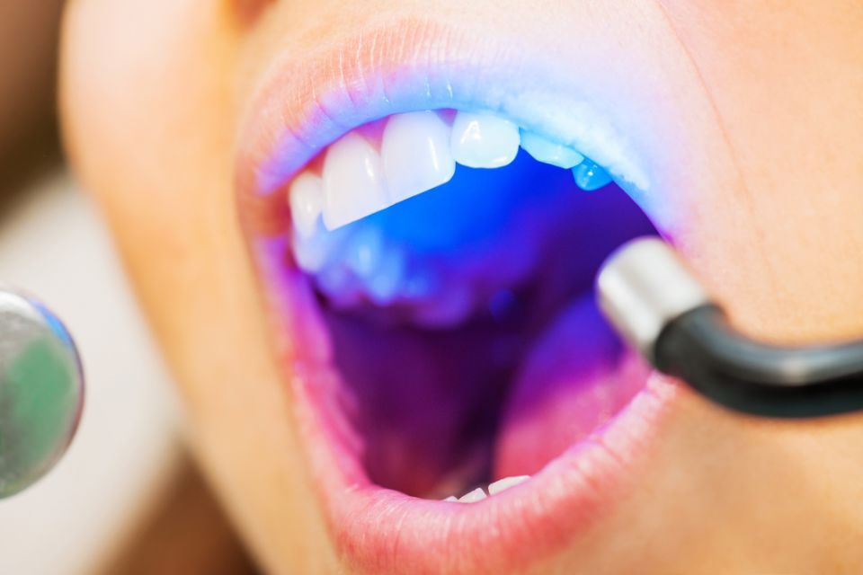 Laser odontoiatrico