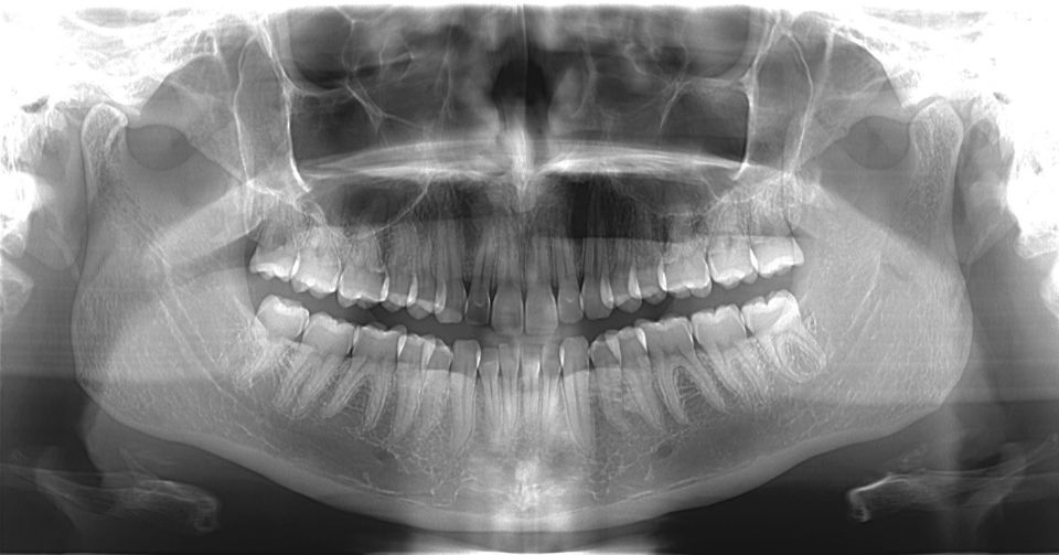 radiologia
