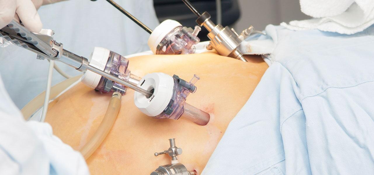 CENTRO QUIRÚRGICO DEL VALLE – BYPASS