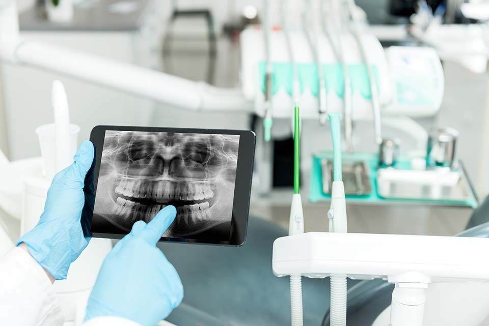 radiografia