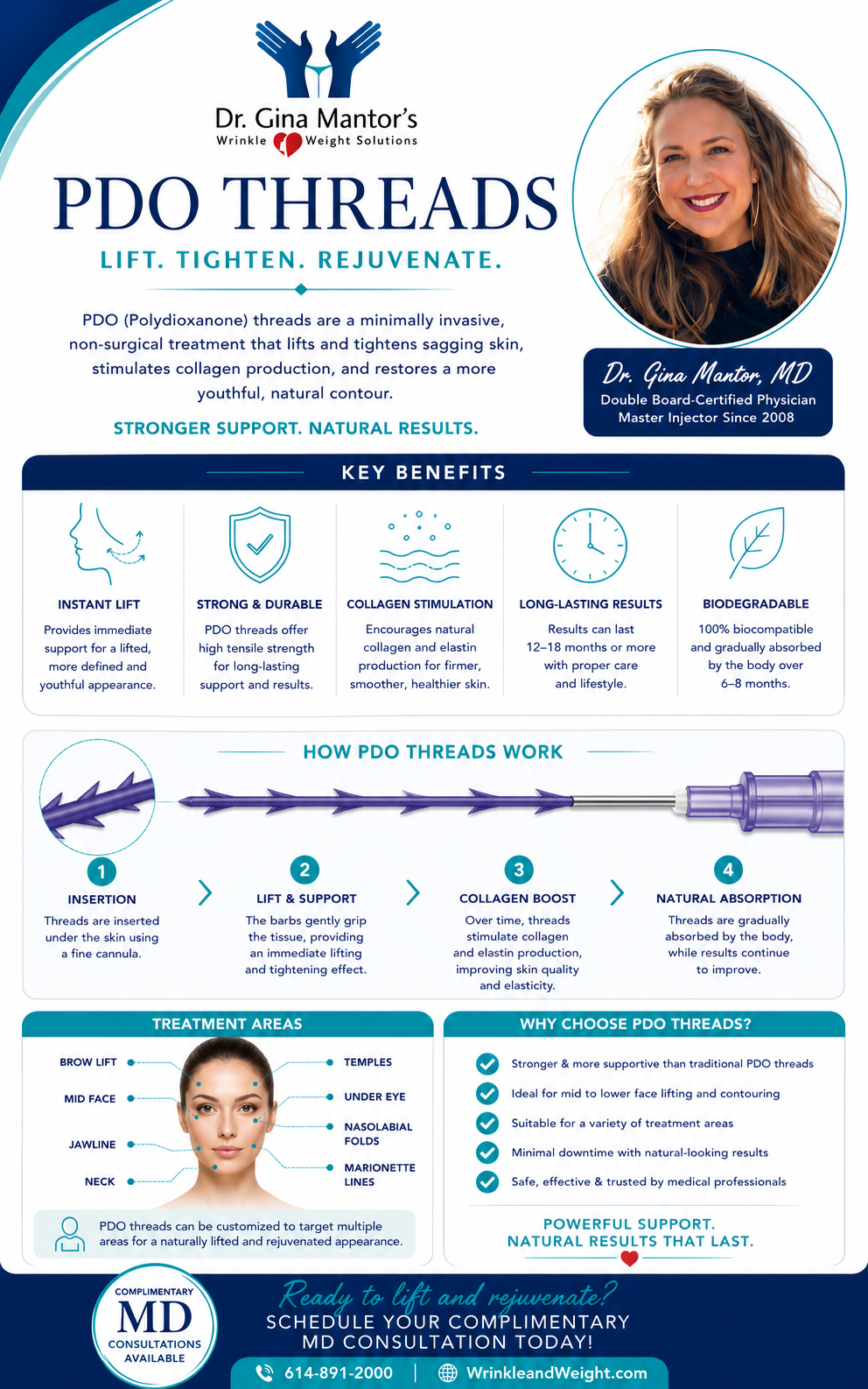 why choose pdo thread lift with Dr. Gina Mantor at Wrinkle and Weight Solutions