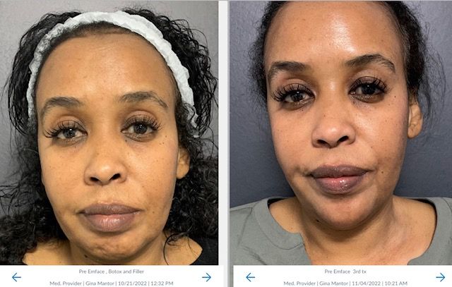Dr. Mantor's Wrinkle and Weight Solutions, LLC - Westerville, Oh - Medical spa