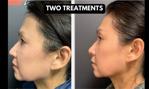 Dr. Mantor's Wrinkle and Weight Solutions, LLC - Westerville, Oh - Medical spa