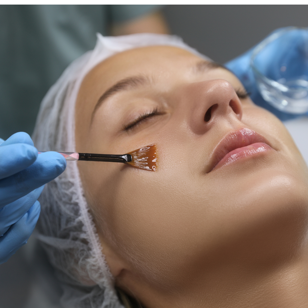 Dr. Mantor's Wrinkle and Weight Solutions, LLC - Westerville, Oh - Medical spa - rejuvenatin peel with skinmedica