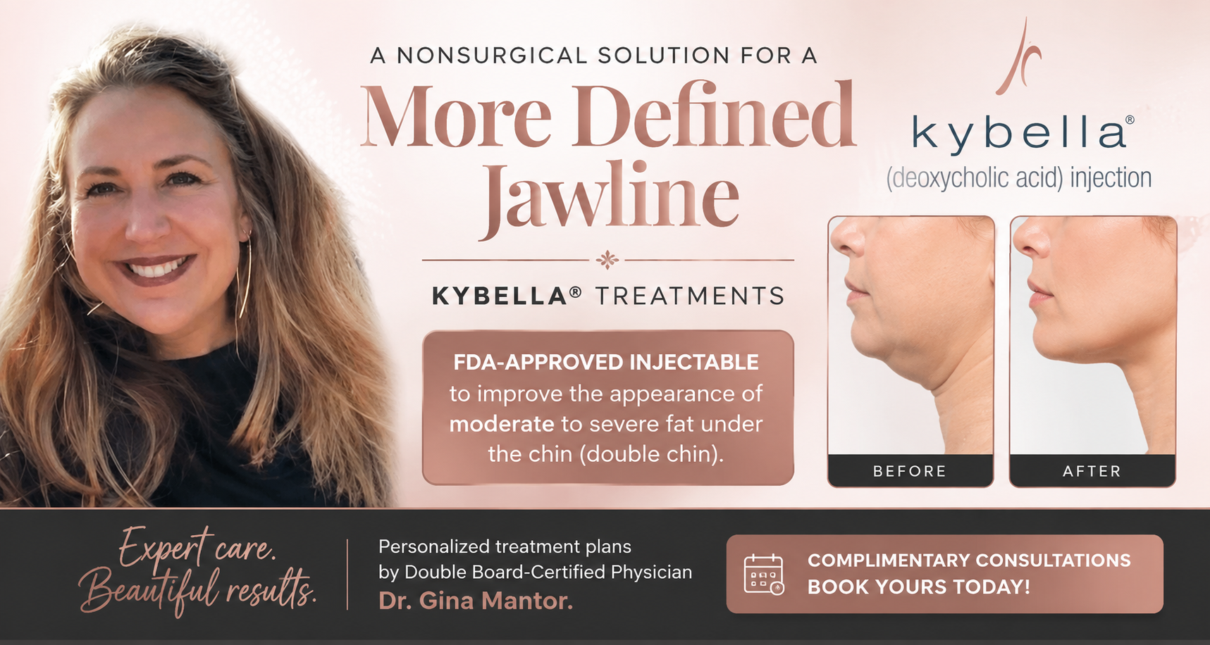 Dr. Gina Mantor with KYBELLA treatment imagery highlighting nonsurgical injectable fat reduction for a more defined jawline.