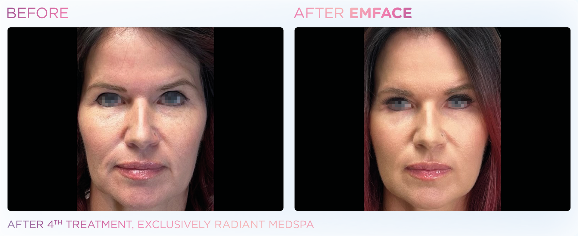 Dr. Mantor's Wrinkle and Weight Solutions, LLC - Westerville, Oh - Medical spa