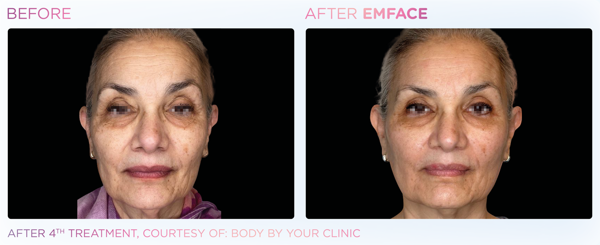 Dr. Mantor's Wrinkle and Weight Solutions, LLC - Westerville, Oh - Medical spa