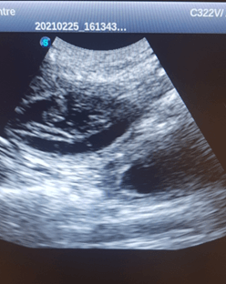 xray image
