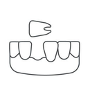 Schéma d'une bouche avec une dent manquante et une dent détachée au-dessus.