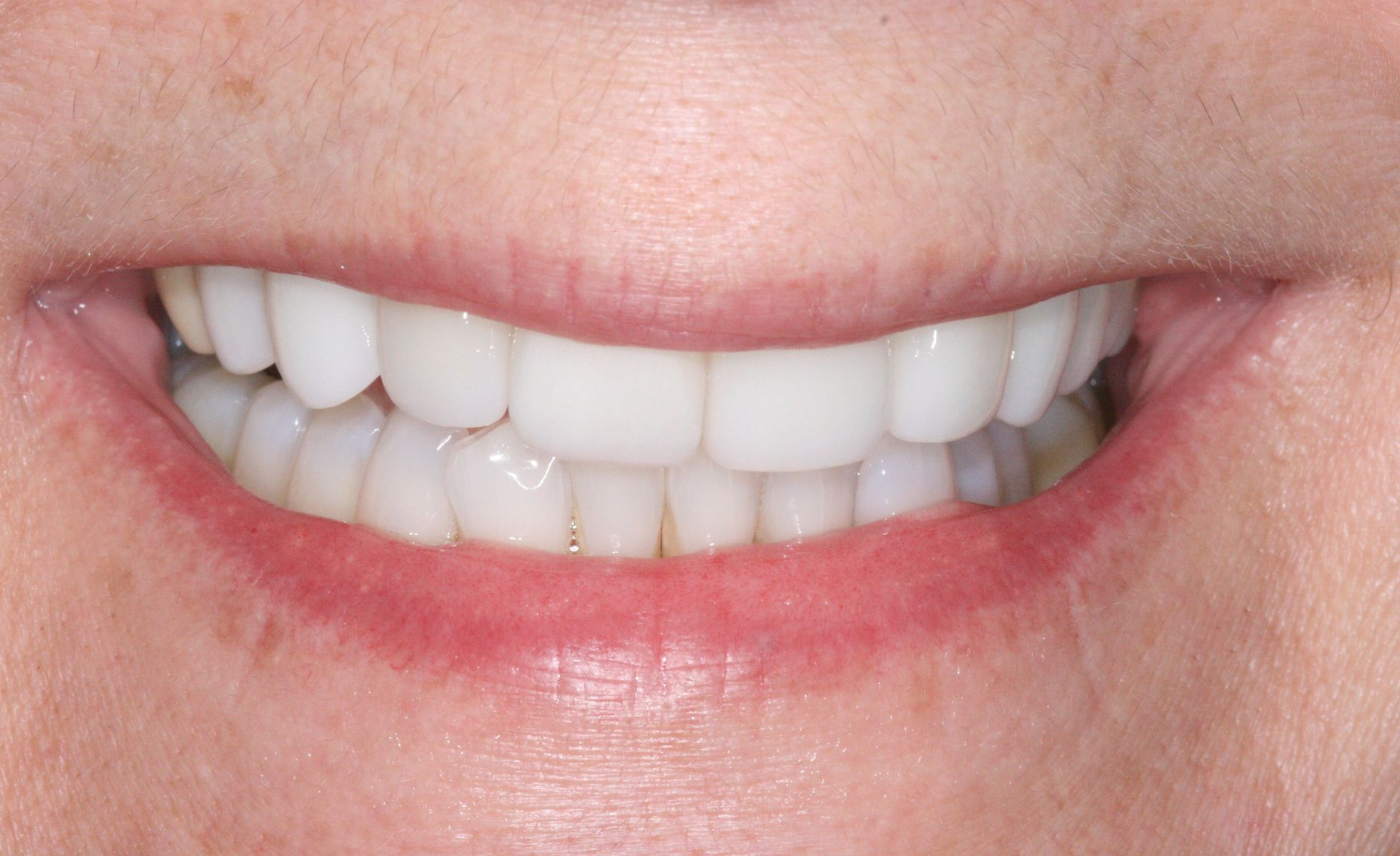 Close-up of a smiling mouth with white teeth and pink lips