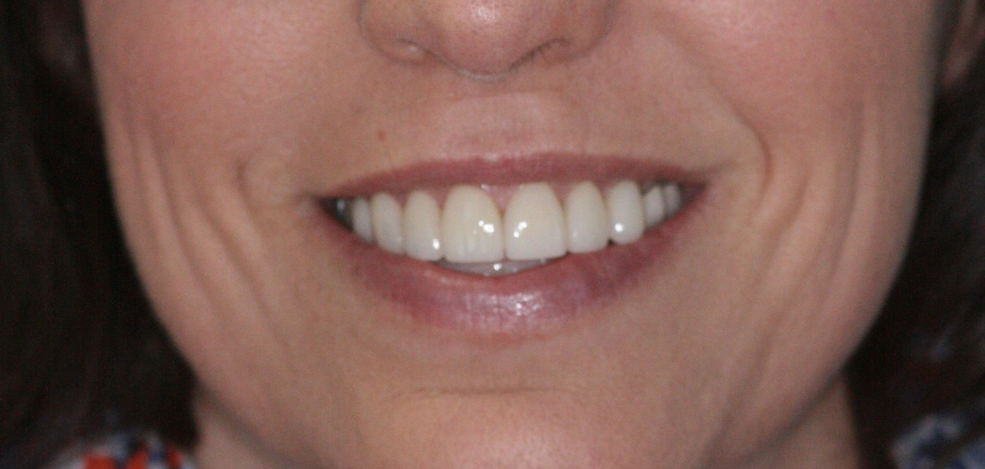 Close-up of a smiling mouth with visible teeth and pink lipstick