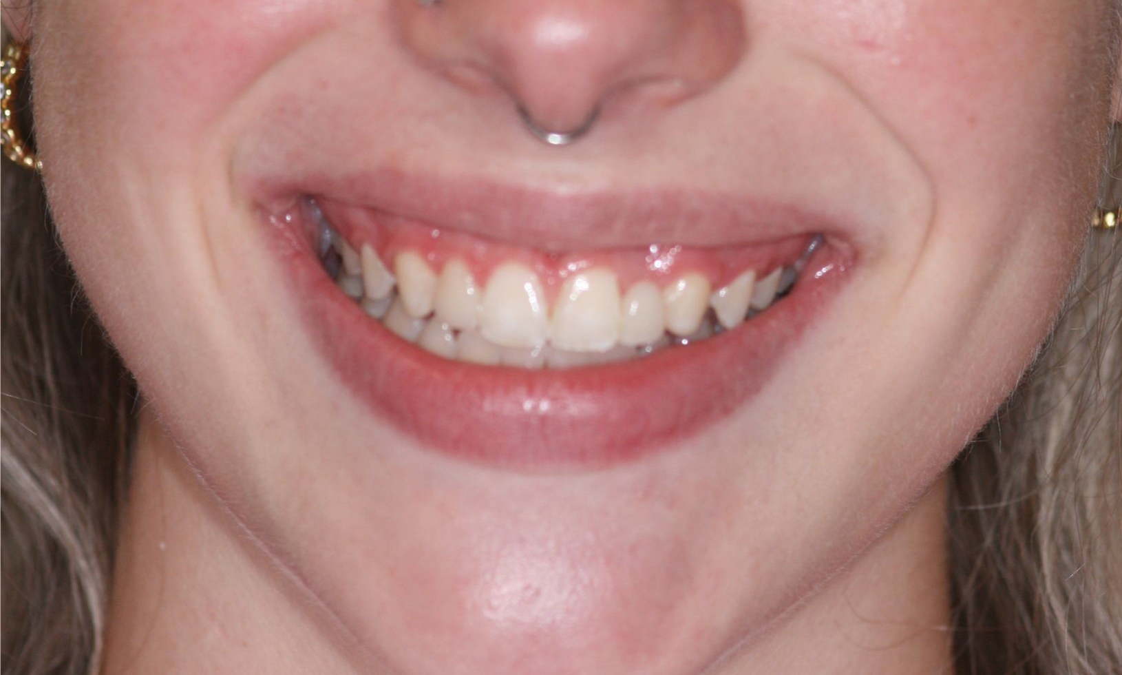 Close-up of a smiling mouth with visible teeth and pink lipstick