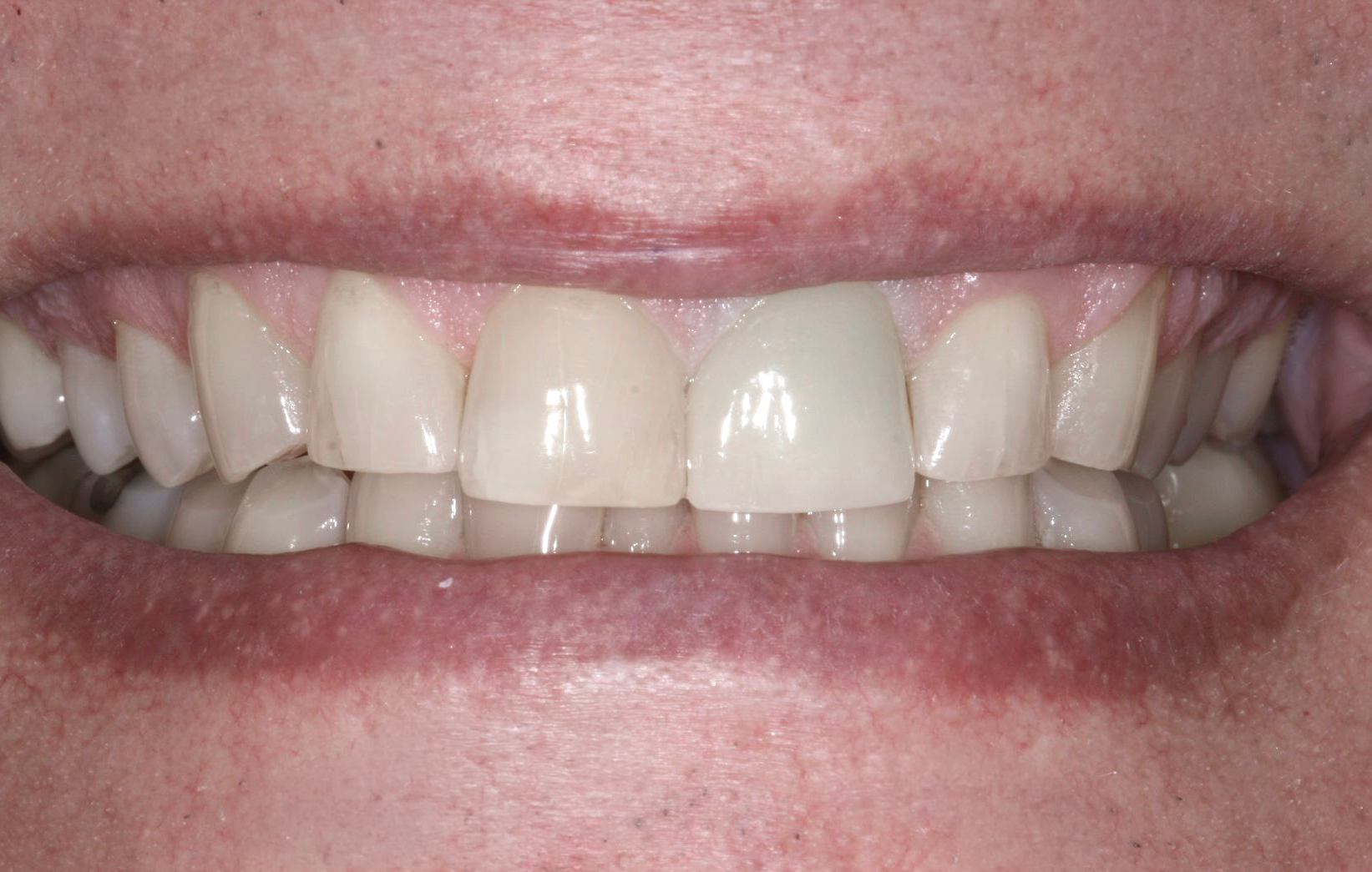 Close-up of a smiling mouth with white teeth and pink lips