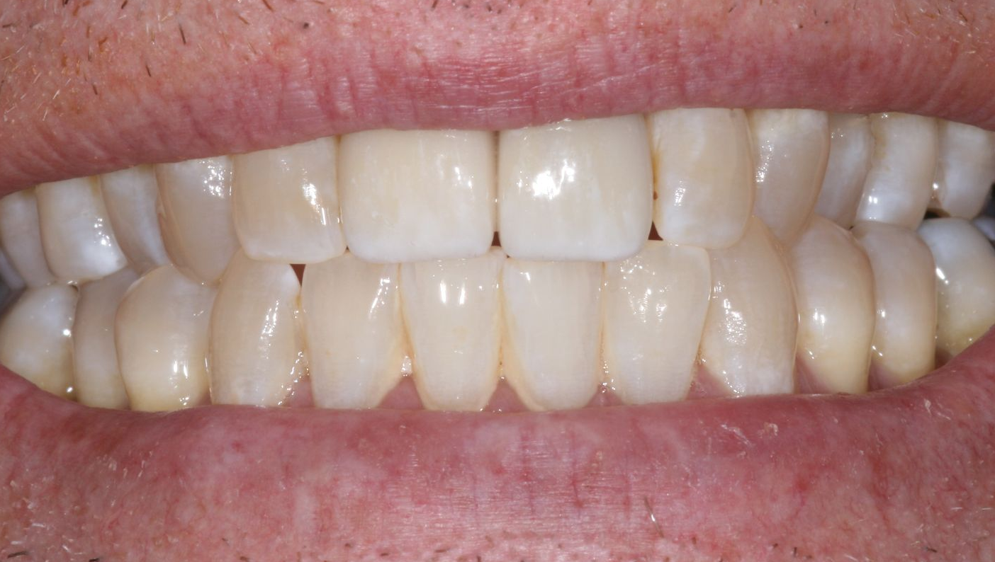 Close-up of a smiling mouth showing white teeth and pink lips