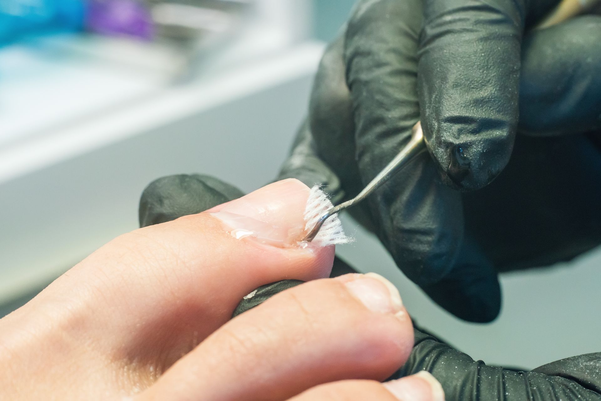 A person with black gloves removes a nail wrap from a toe with a metal tool.
