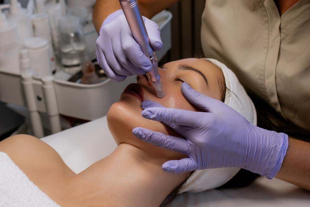 Gloved Clinician Giving Collagen Into a Patient’s Cheek During a Cosmetic Procedure — Embrace Cosmetic Clinic in Bundaberg North, QLD