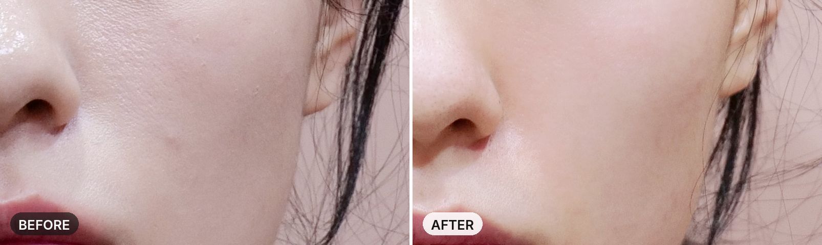 Potenza before and after, case 3, JRYN Seomyeon Busan