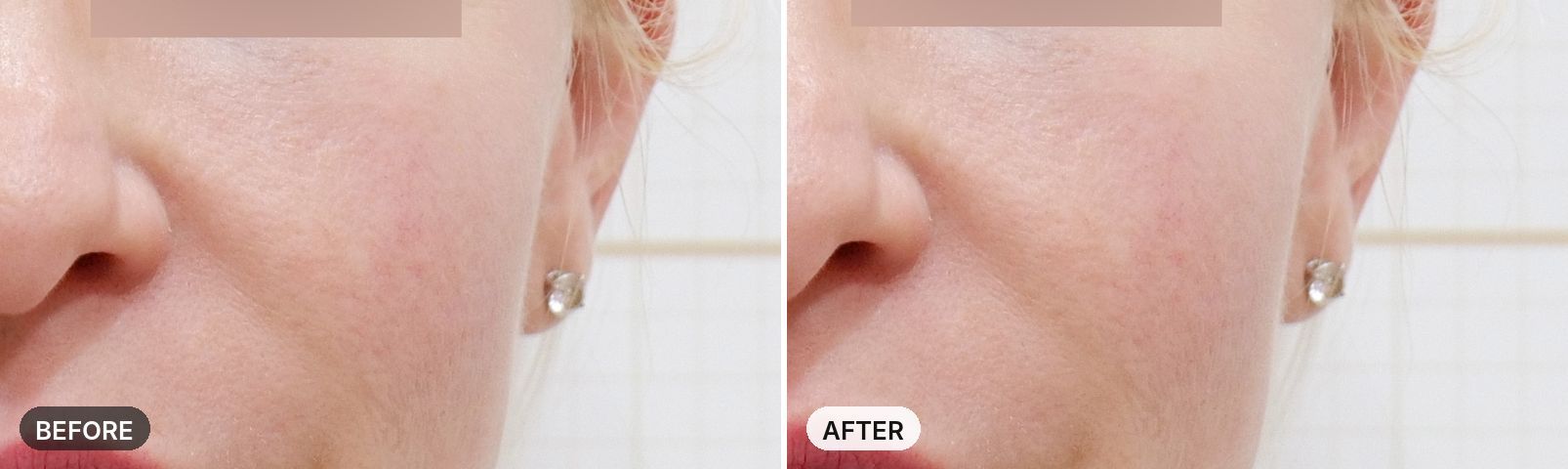 Potenza before and after, case 5, JRYN Seomyeon Busan