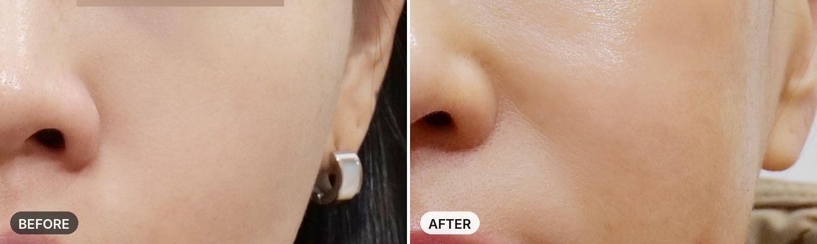 Potenza before and after, case 8, JRYN Seomyeon Busan