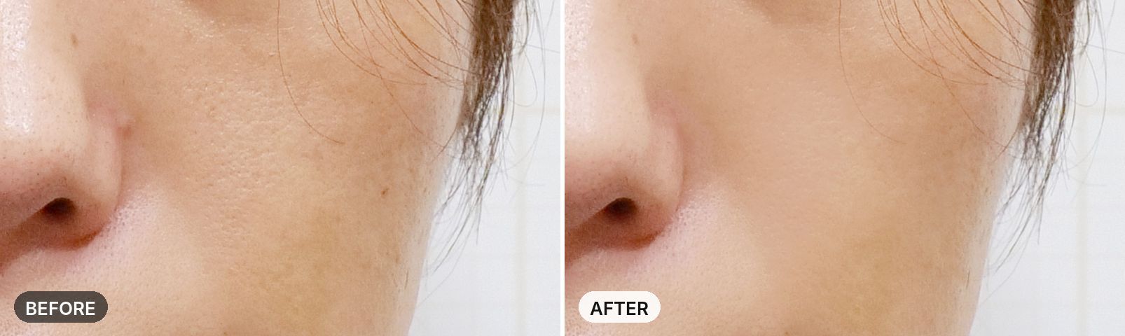 Potenza before and after, case 6, JRYN Seomyeon Busan