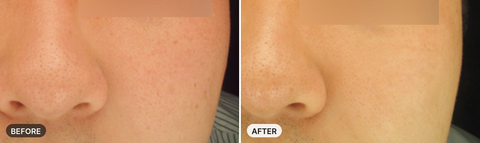 Premium All-in-One Course before and after, case 3, JRYN Seomyeon Busan