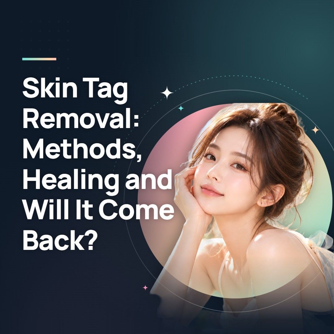 Skin Tag Removal: Methods, Healing and Will It Come Back?