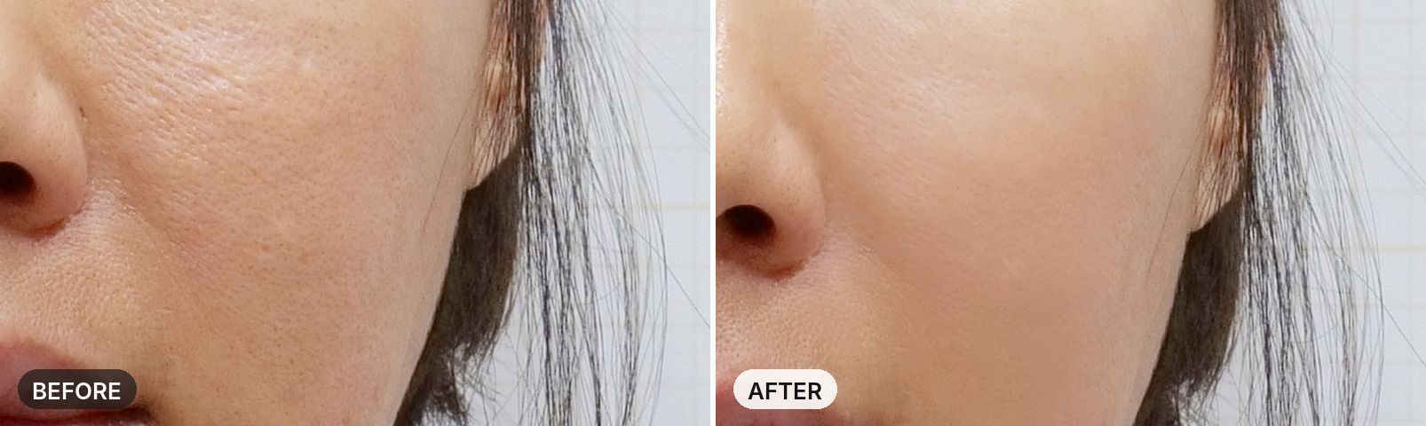 Potenza before and after, case 4, JRYN Seomyeon Busan