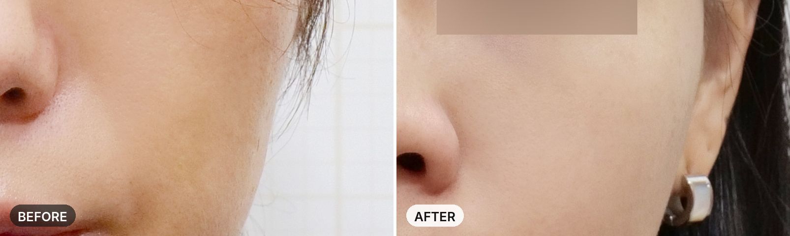 Potenza before and after, case 7, JRYN Seomyeon Busan