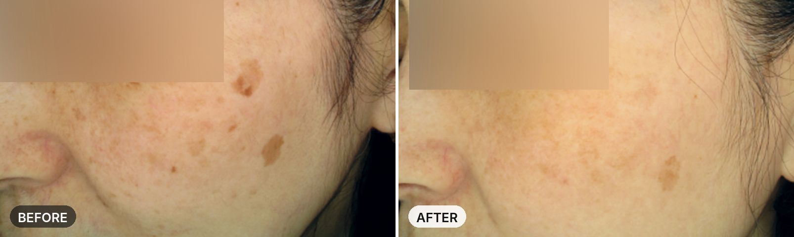 Premium All-in-One Course before and after