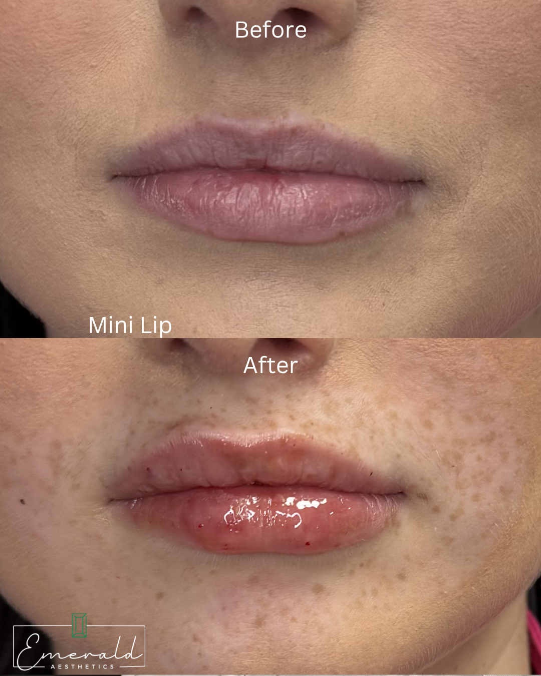 Before-and-after close-up of lips showing fuller, glossier lip makeup treatment.