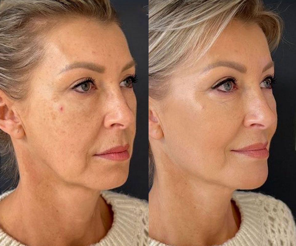 Woman applying skincare to her face while looking in a mirror
