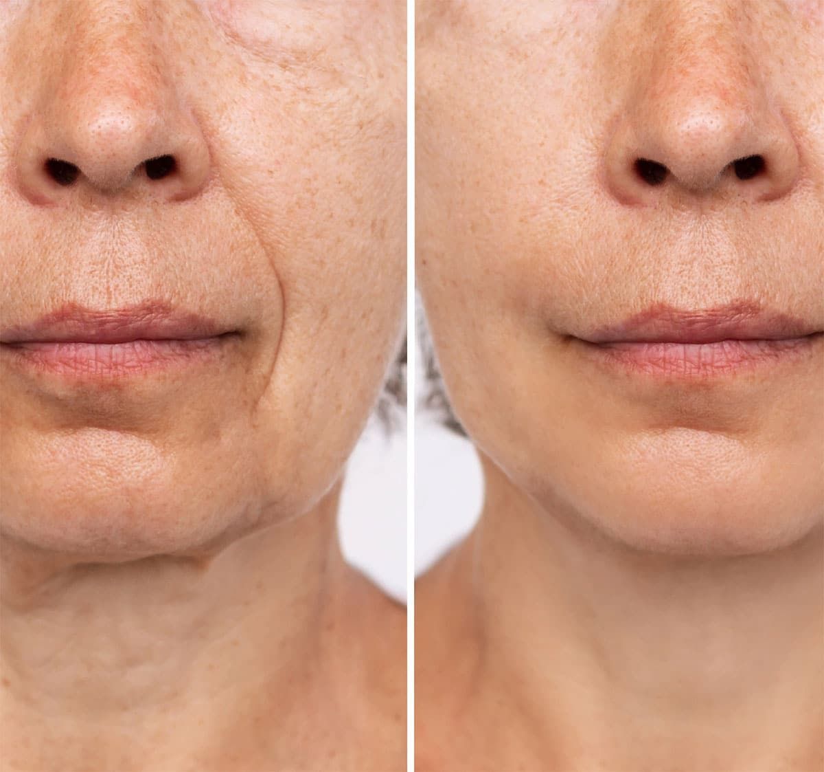 Close-up portrait of a face split by a vertical line, eyes closed, hands touching both cheeks.
