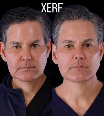 Side-by-side portrait of the same man, one raw and one smoother, with “XERF” above.