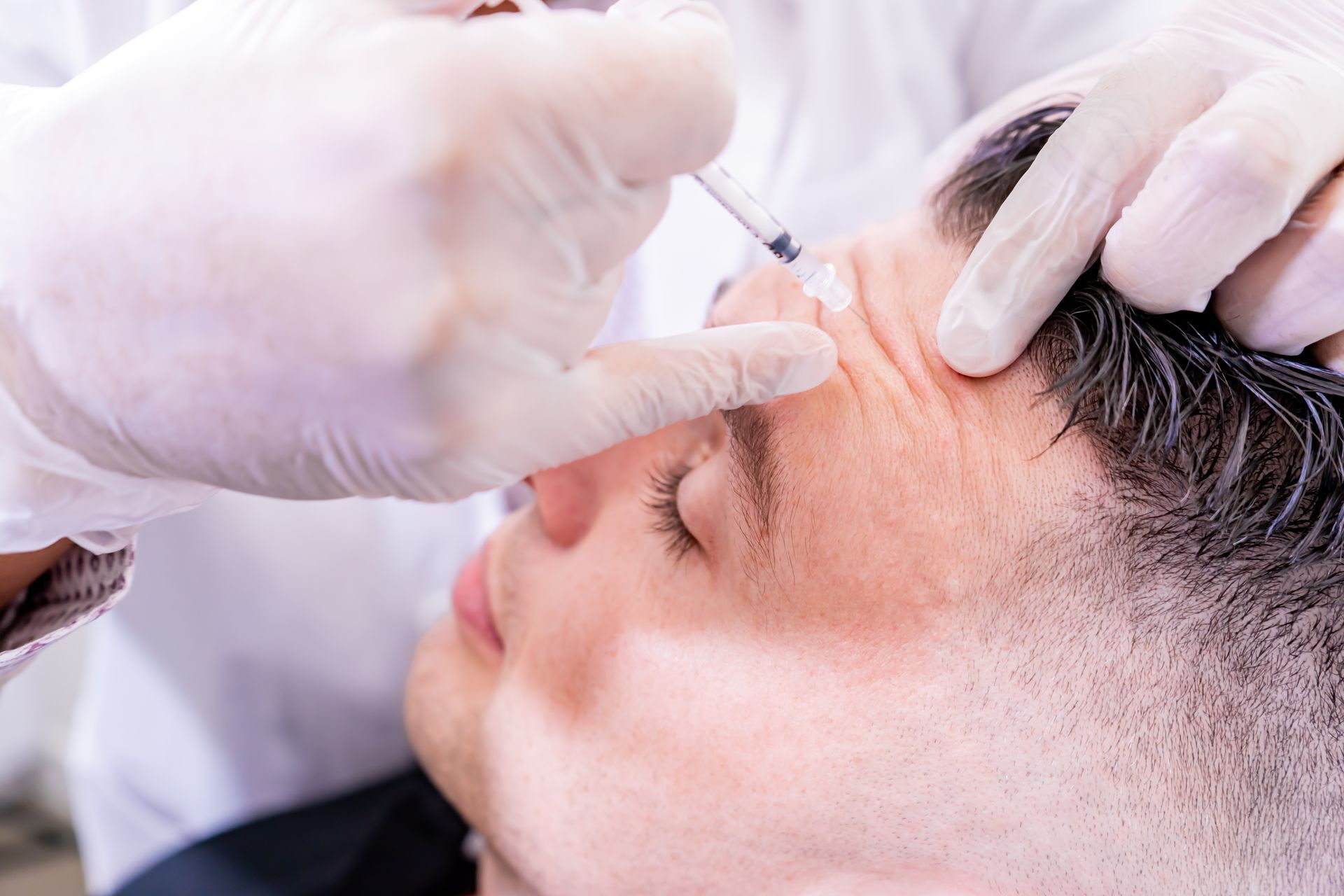 Gloved practitioner injecting a man's forehead with a syringe during a cosmetic procedure