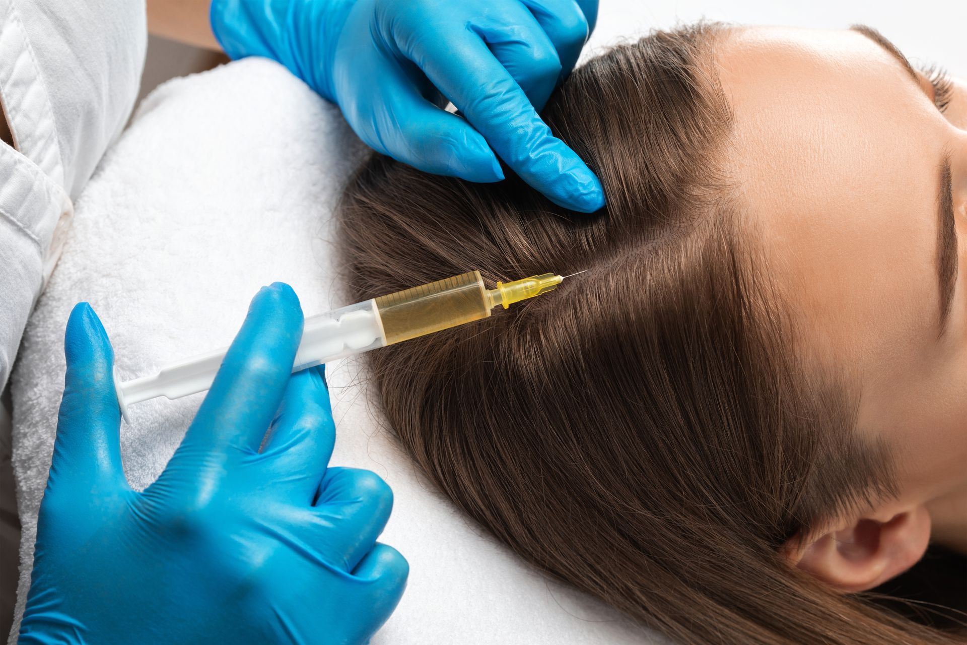 Person receiving a hair treatment injection in a clinical setting. The medical professional uses a syringe.