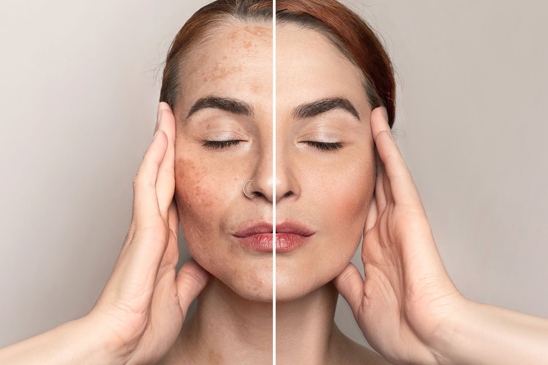 Split-face portrait of a person before and after skincare, eyes closed, hands on cheeks