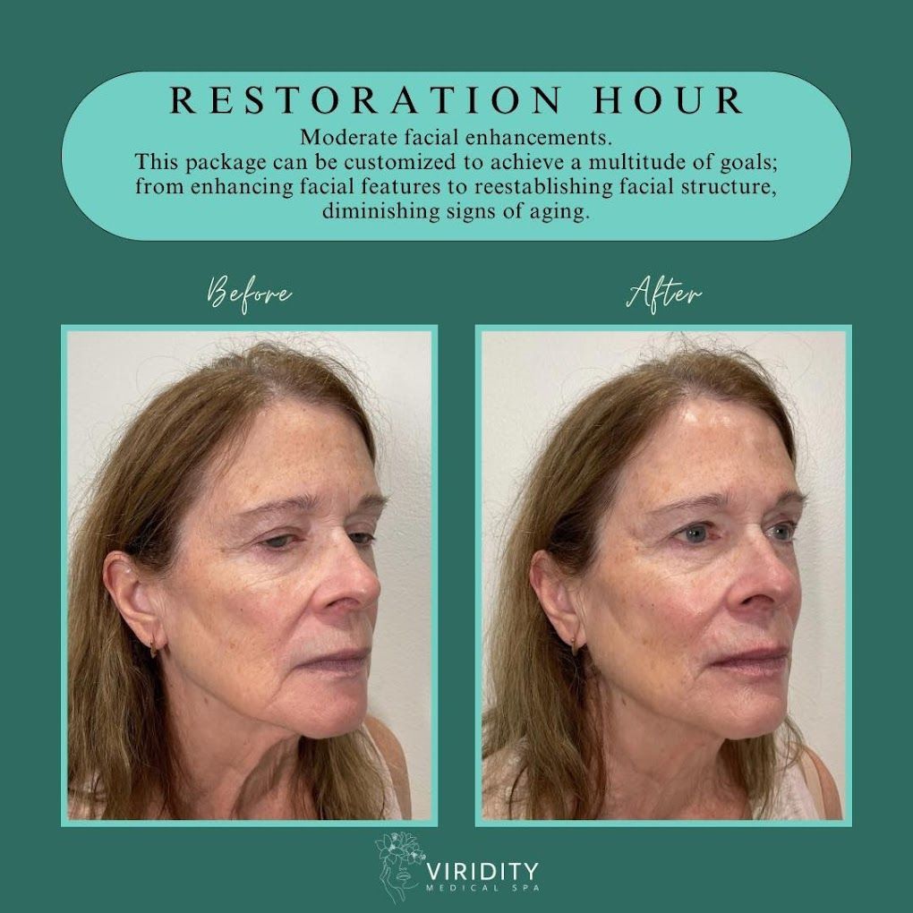 A before and after photo of a woman 's face.