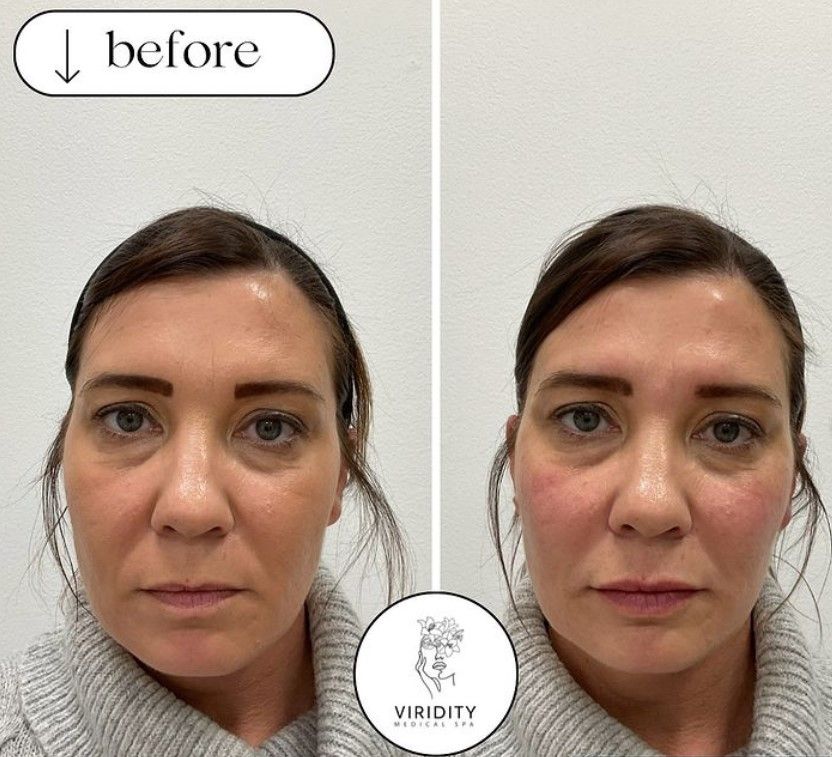 A before and after photo of a woman 's face