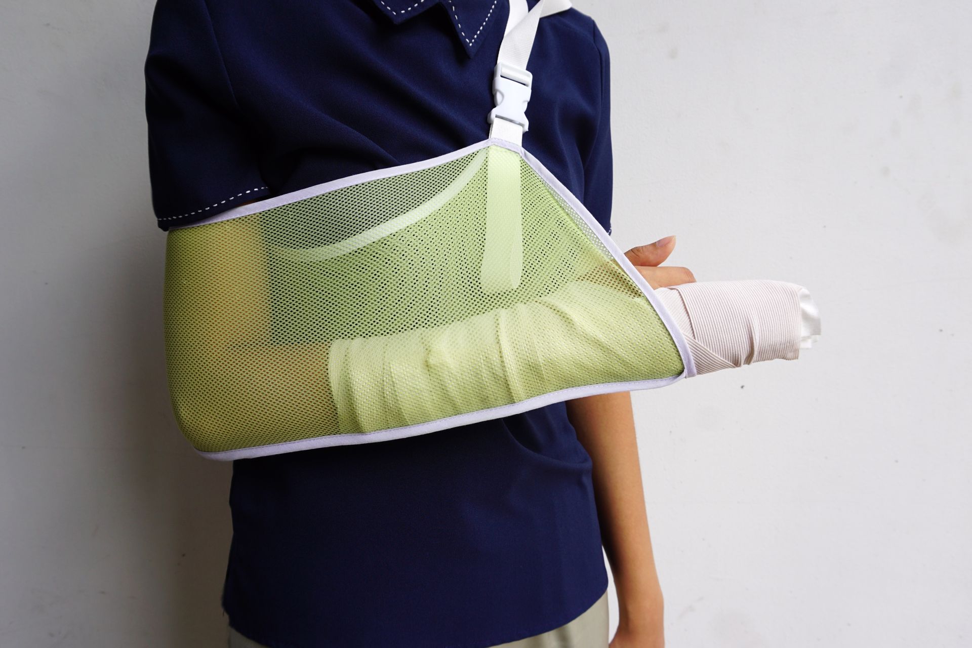 A person with a broken arm in a green sling