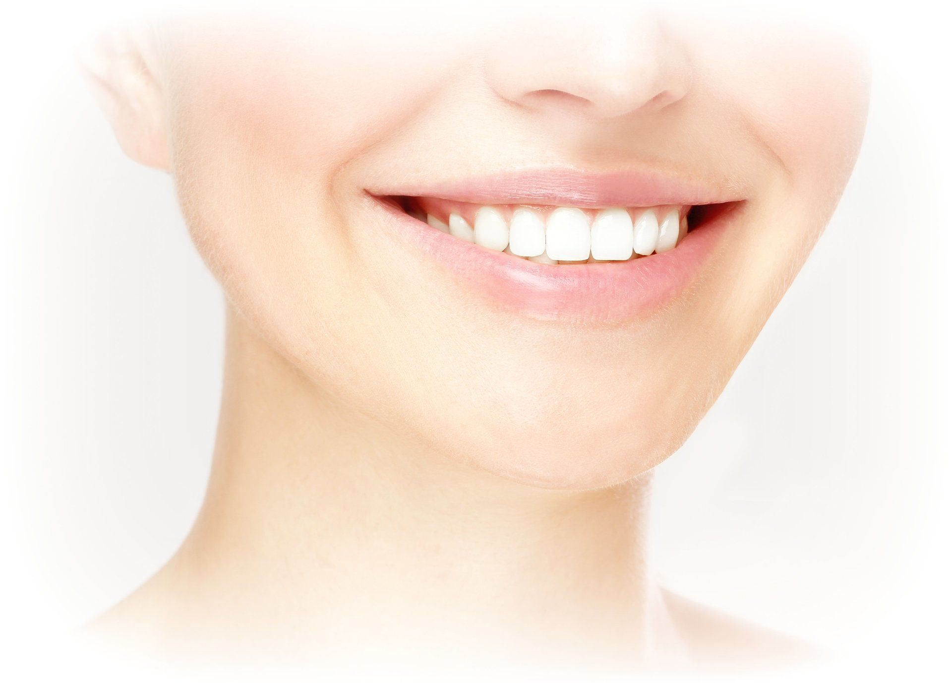 Gingivectomy