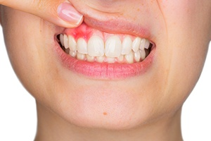 Osseous surgery