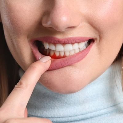 woman pulling down her bottom right lip with her right finger