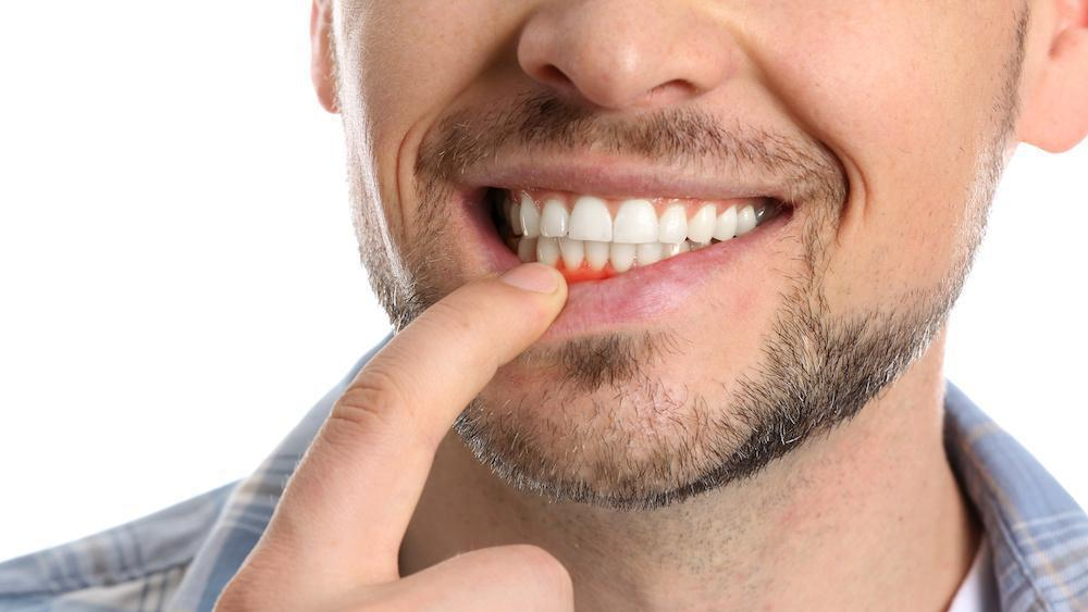 A man with a beard is pointing at his teeth.