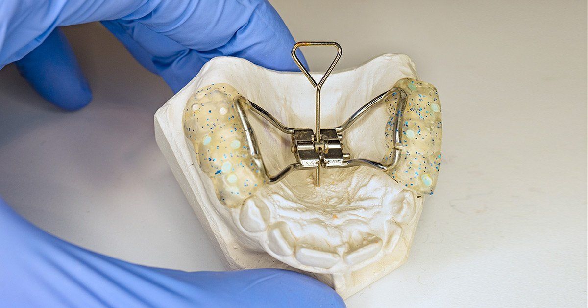 palate expander