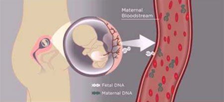 cfdna nipt