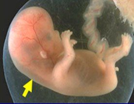 translucenza normale