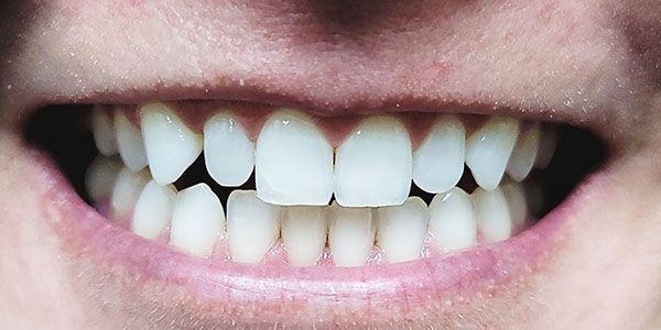 Close-up of a smiling mouth with white teeth and pink lips
