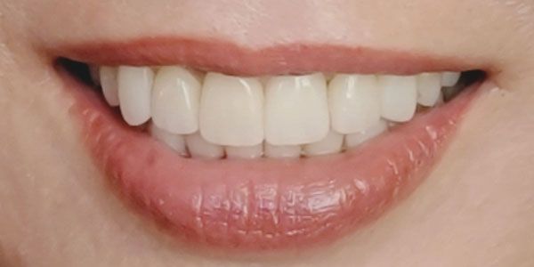 Close-up of smiling mouth with white teeth and pink lips