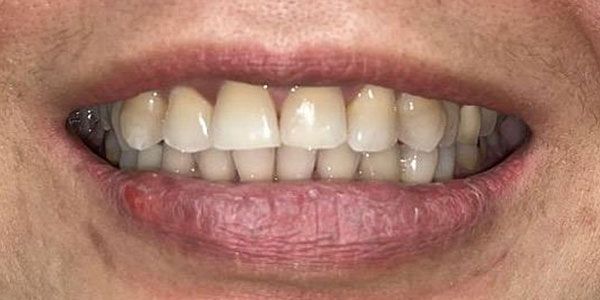 Close-up of a smiling mouth showing teeth and lips